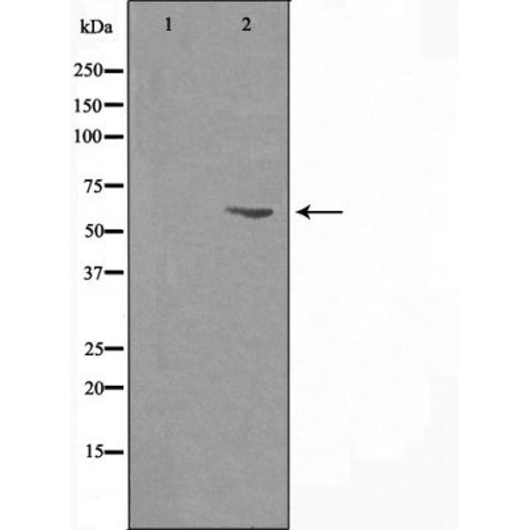 Western blot analysis of Hela cells using 27A1 (Cytochrome P450) antibody