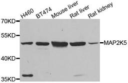 Western blot analysis of extracts of various cell lines using MAP2K5 antibody