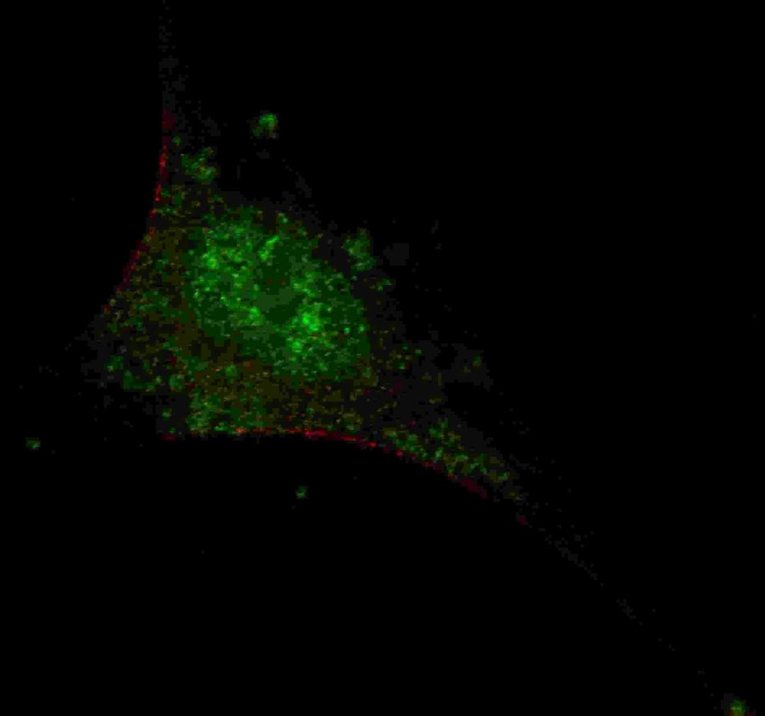 Fluorescent confocal image of SY5Y cells stained with SMAD2 (T220) antibody. SY5Y cells were fixed with 4% PFA (20 min), permeabilized with Triton X-100 (0.2%, 30 min). Cells were then incubated with SMAD2 (T220) primary antibody (1:200, 2 h at room tempe