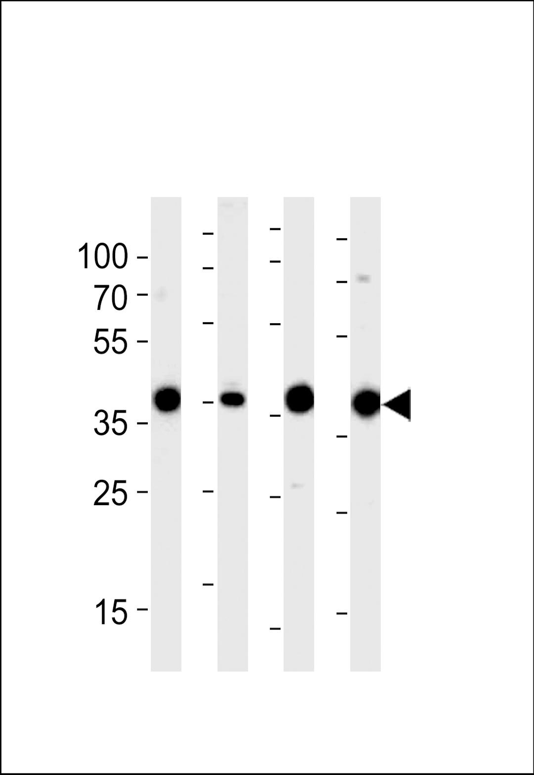 Western blot analysis of lysates from 293,RD,mouse NIH/3T3,rat L6 cell line (from left to right),using ALDOA Antibody at 1:1000 at each lane.