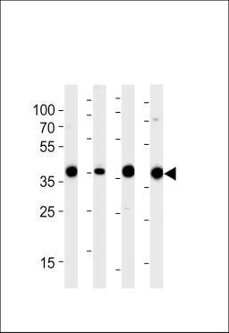 Western blot analysis of lysates from 293,RD,mouse NIH/3T3,rat L6 cell line (from left to right),using ALDOA Antibody at 1:1000 at each lane.