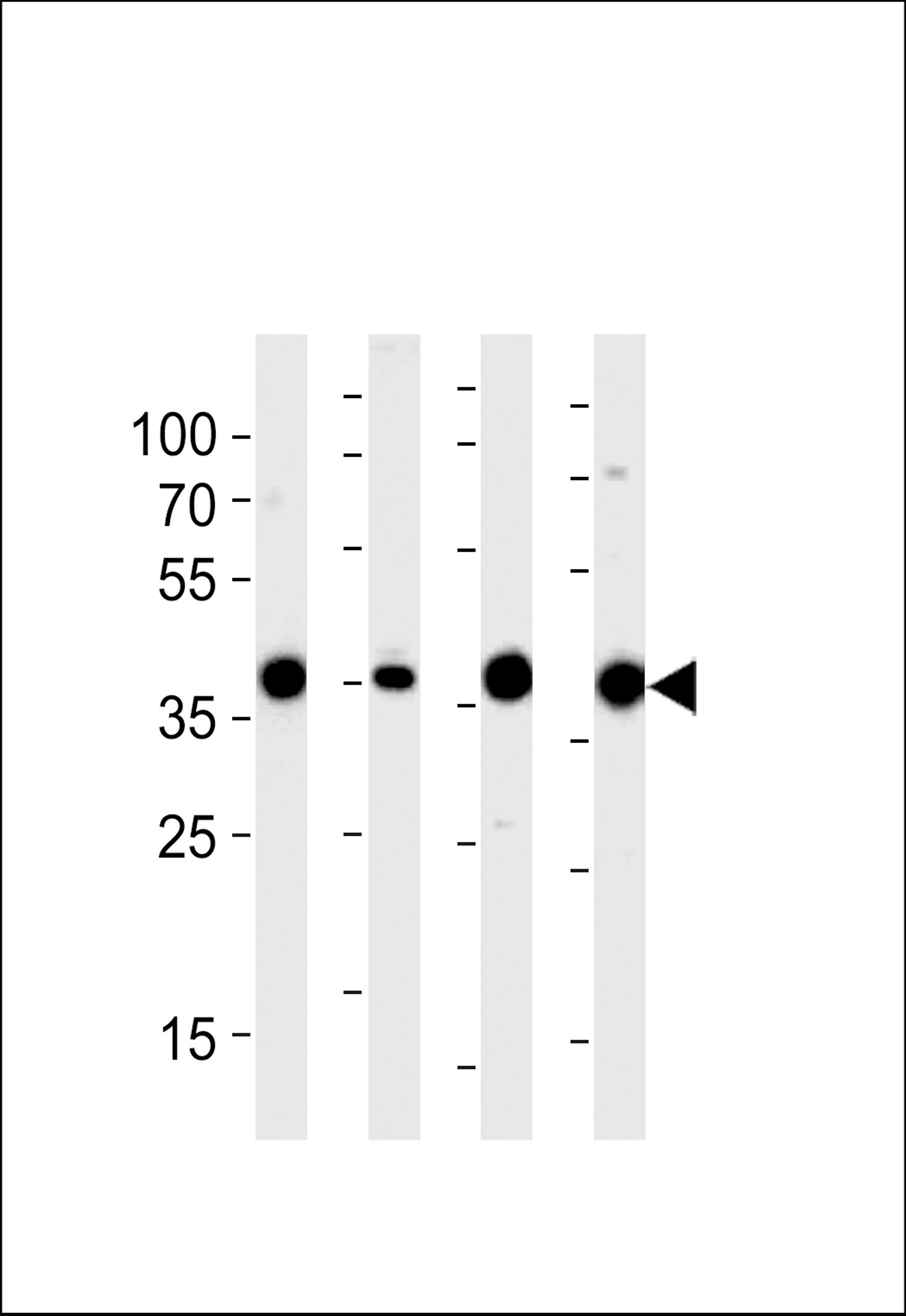 Western blot analysis of lysates from 293,RD,mouse NIH/3T3,rat L6 cell line (from left to right),using ALDOA Antibody at 1:1000 at each lane.