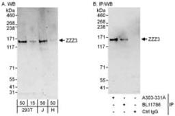 Detection of human ZZZ3 by western blot and immunoprecipitation.