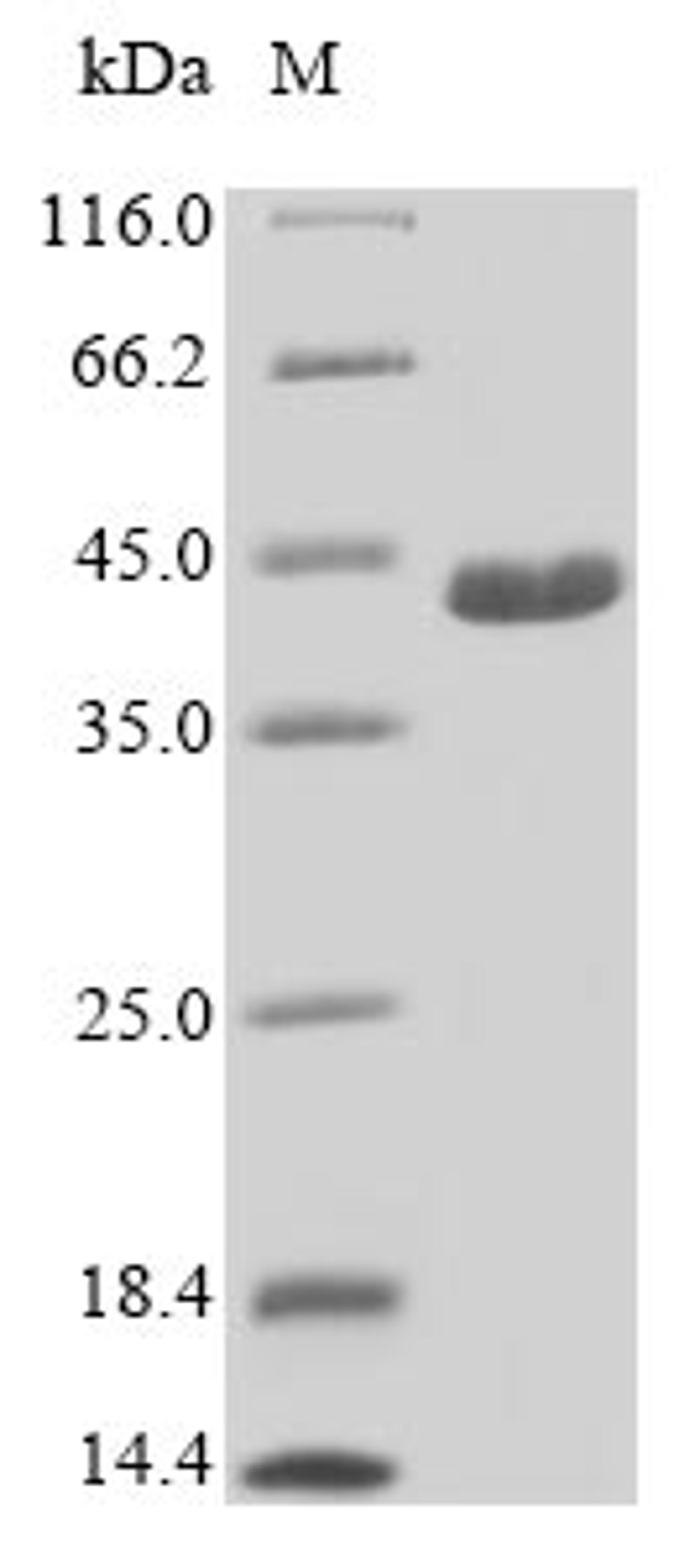 (Tris-Glycine gel) Discontinuous SDS-PAGE (reduced) with 5% enrichment gel and 15% separation gel.
