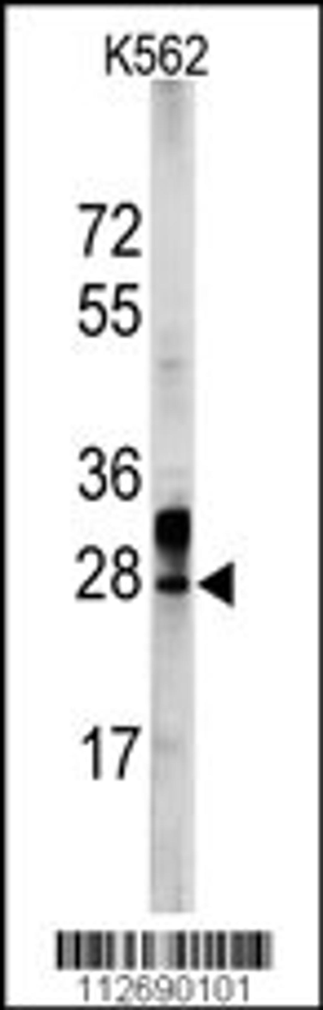 Western blot analysis of ERAS Antibody in K562 cell line lysates (35ug/lane)