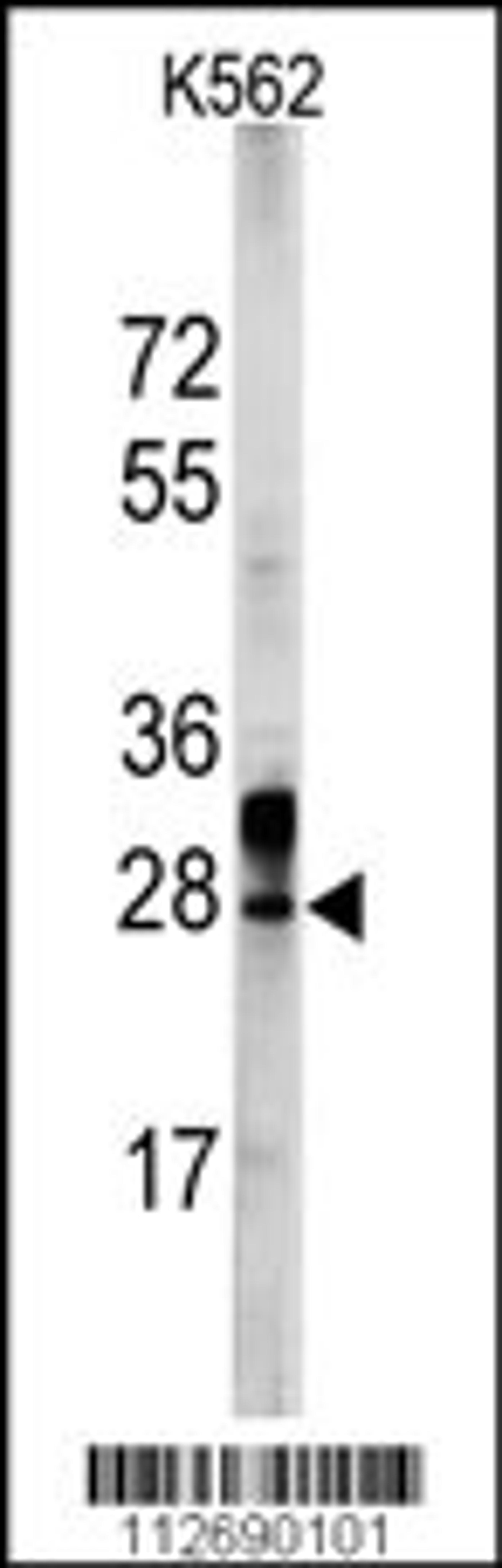 Western blot analysis of ERAS Antibody in K562 cell line lysates (35ug/lane)