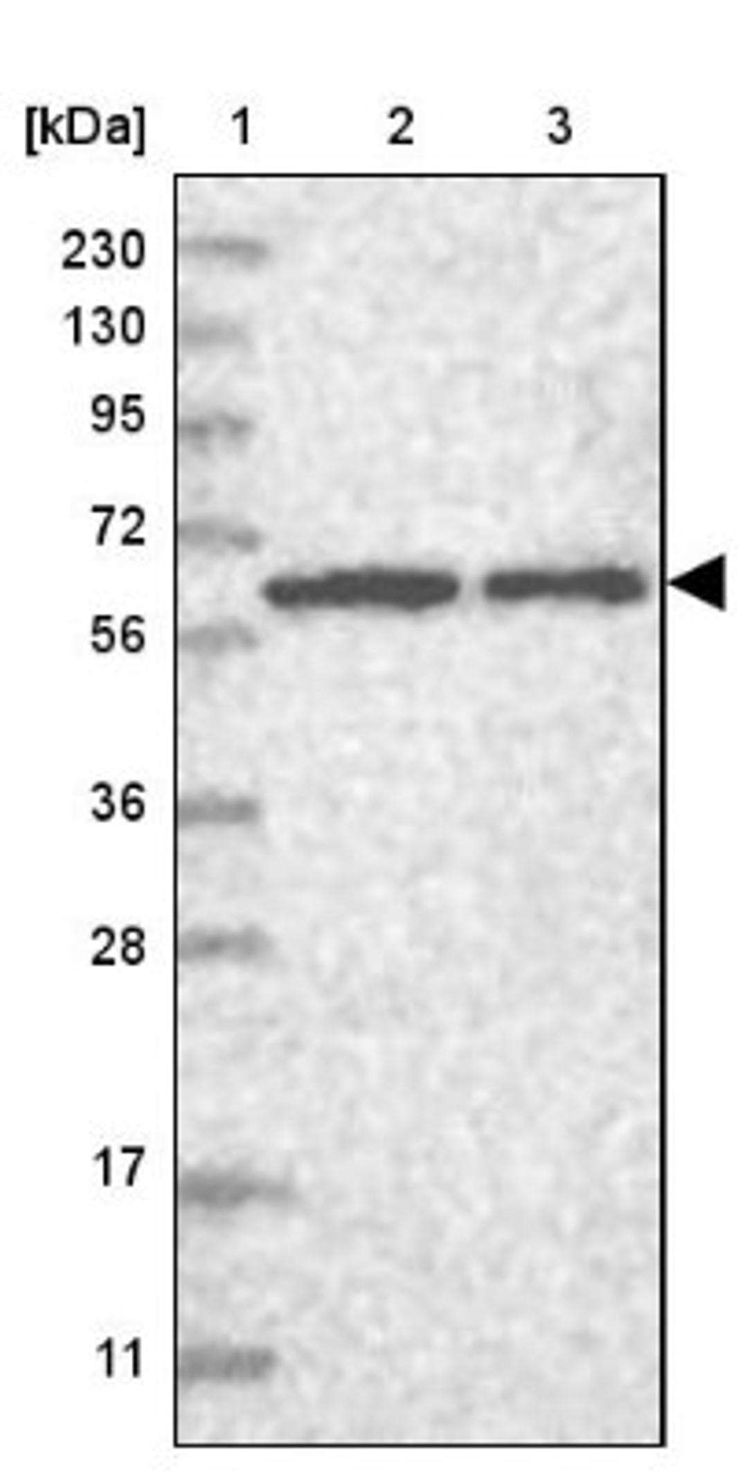 Western Blot: C10orf81 Antibody [NBP1-88807] - Lane 1: Marker [kDa] 230, 130, 95, 72, 56, 36, 28, 17, 11<br/>Lane 2: Human cell line RT-4<br/>Lane 3: Human cell line U-251MG sp