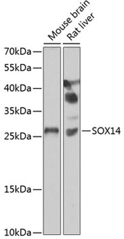 Western blot - SOX14 antibody (A7217)