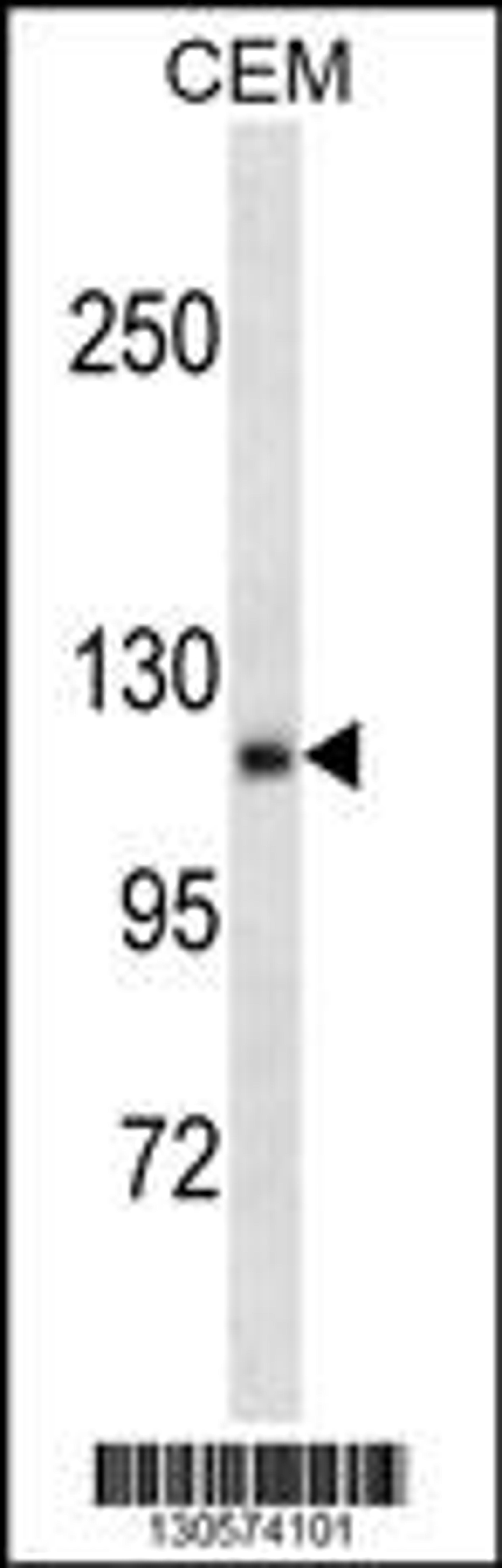 Western blot analysis in CEM cell line lysates (35ug/lane).