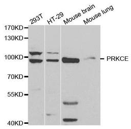 Western blot analysis of extracts of various cell lines using PRKCE antibody