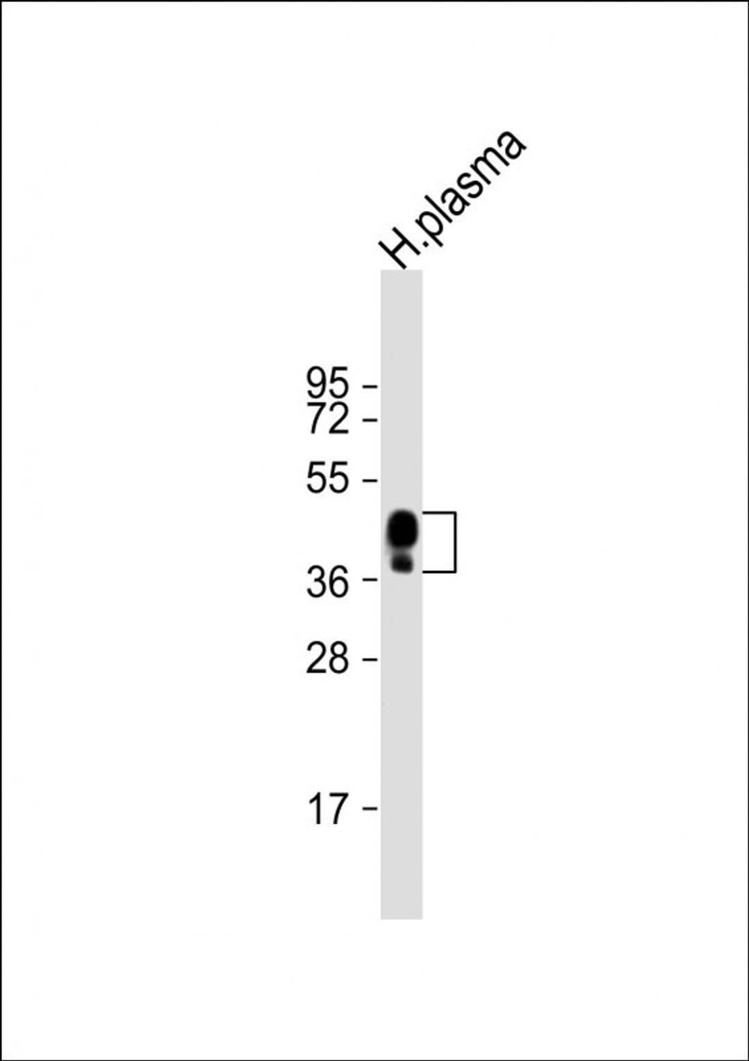 Western Blot at 1:2000 dilution + human plasma lysate Lysates/proteins at 20 ug per lane.