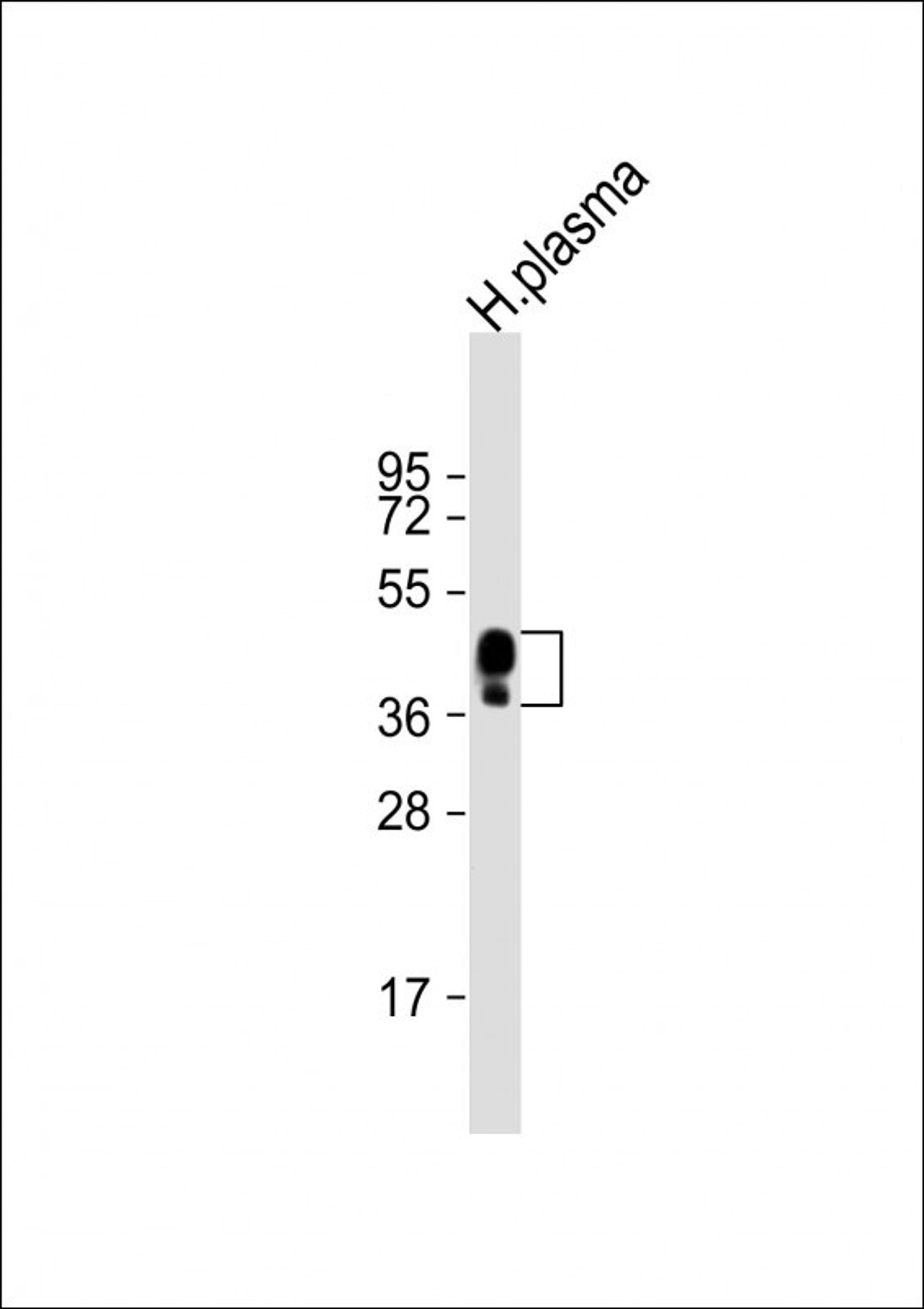 Western Blot at 1:2000 dilution + human plasma lysate Lysates/proteins at 20 ug per lane.