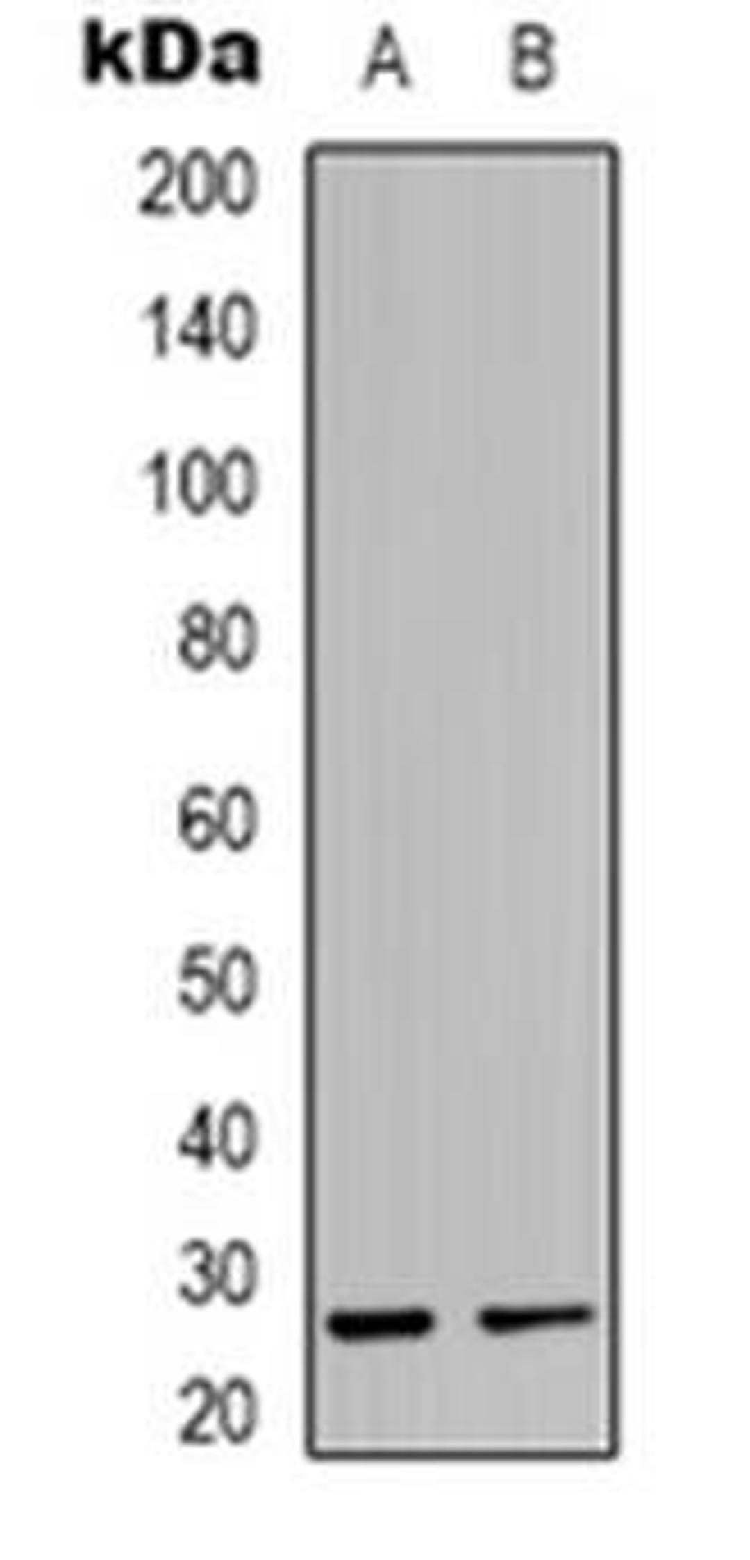 Western blot analysis of MOB3C expression in K562 (Lane 1), mouse heart (Lane 2) whole cell lysates using MOB3C antibody