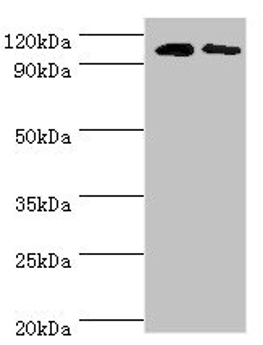 Western blot. All lanes: Cytosolic 10-formyltetrahydrofolate dehydrogenase antibody at 8ug/ml. Lane 1: Mouse liver tissue. Lane 2: Mouse gonad tissue. Secondary. Goat polyclonal to rabbit IgG at 1/10000 dilution. Predicted band size: 99, 88, 100, 56 kDa. Observed band size: 99 kDa.