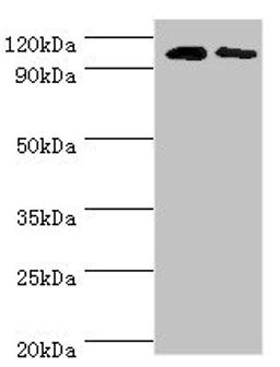 Western blot. All lanes: Cytosolic 10-formyltetrahydrofolate dehydrogenase antibody at 8ug/ml. Lane 1: Mouse liver tissue. Lane 2: Mouse gonad tissue. Secondary. Goat polyclonal to rabbit IgG at 1/10000 dilution. Predicted band size: 99, 88, 100, 56 kDa. Observed band size: 99 kDa.