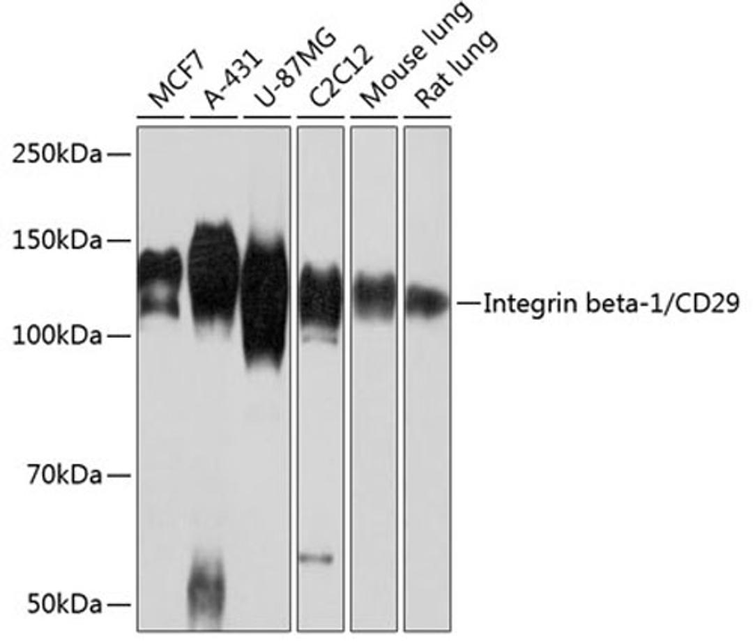 Western blot - Integrin beta-1/CD29 antibody (A19072)