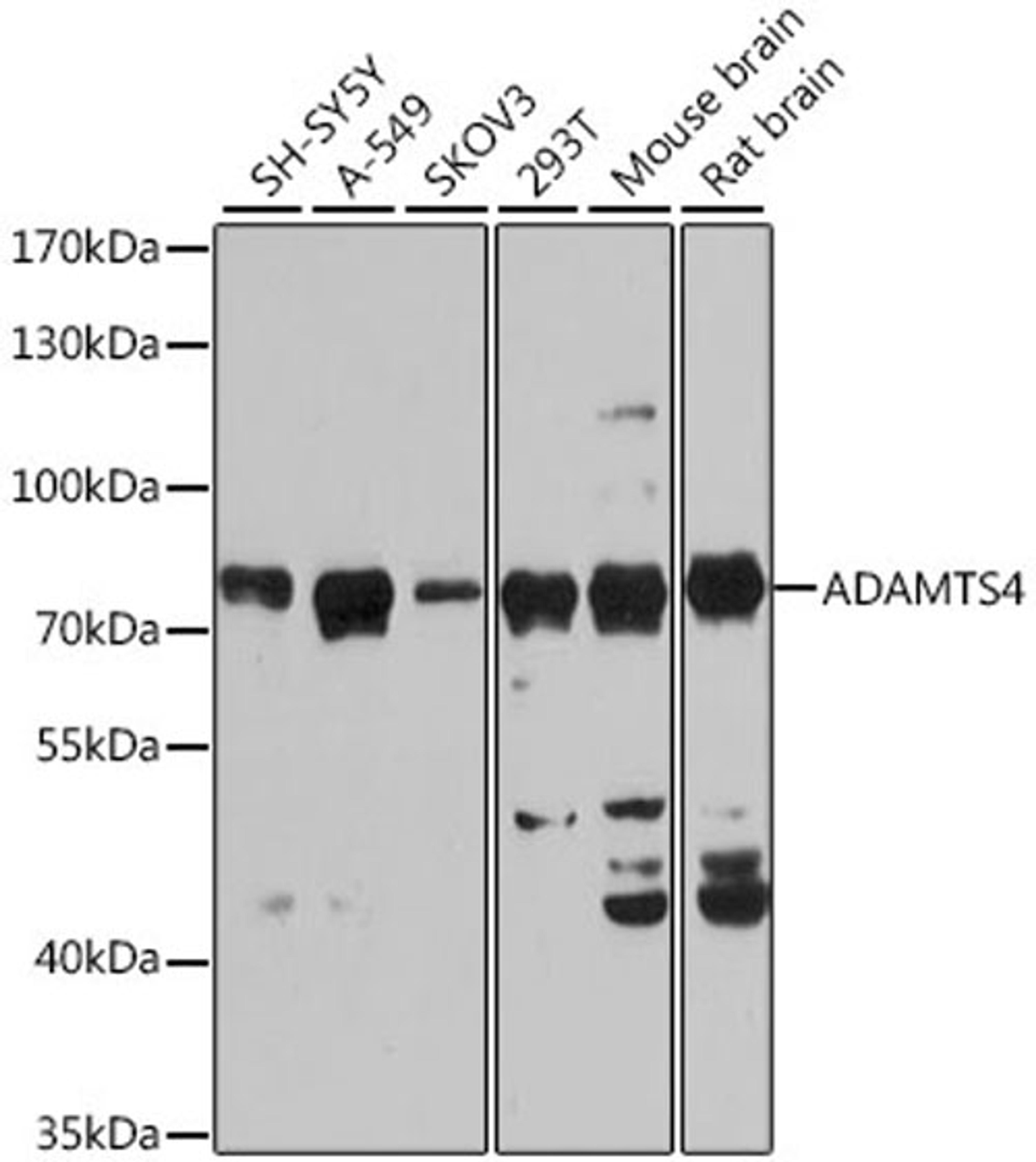 Western blot - ADAMTS4 antibody (A2525)