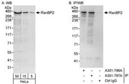 Detection of human RanBP2 by western blot and immunoprecipitation.