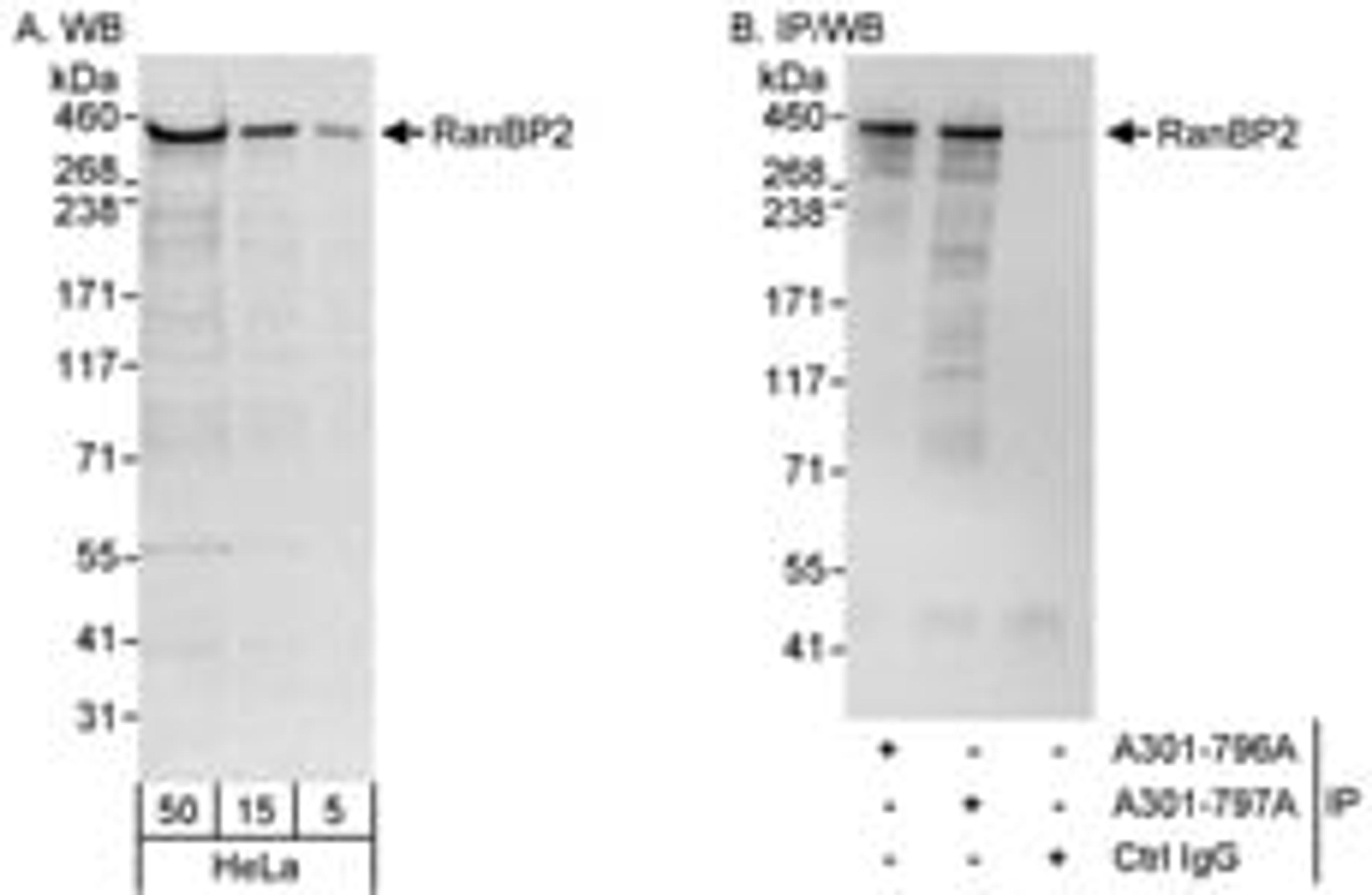 Detection of human RanBP2 by western blot and immunoprecipitation.