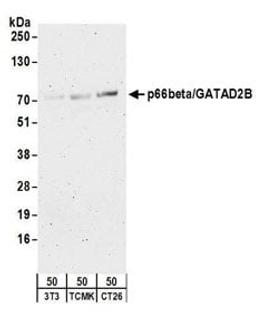 Detection of mouse p66beta/GATAD2B by western blot.