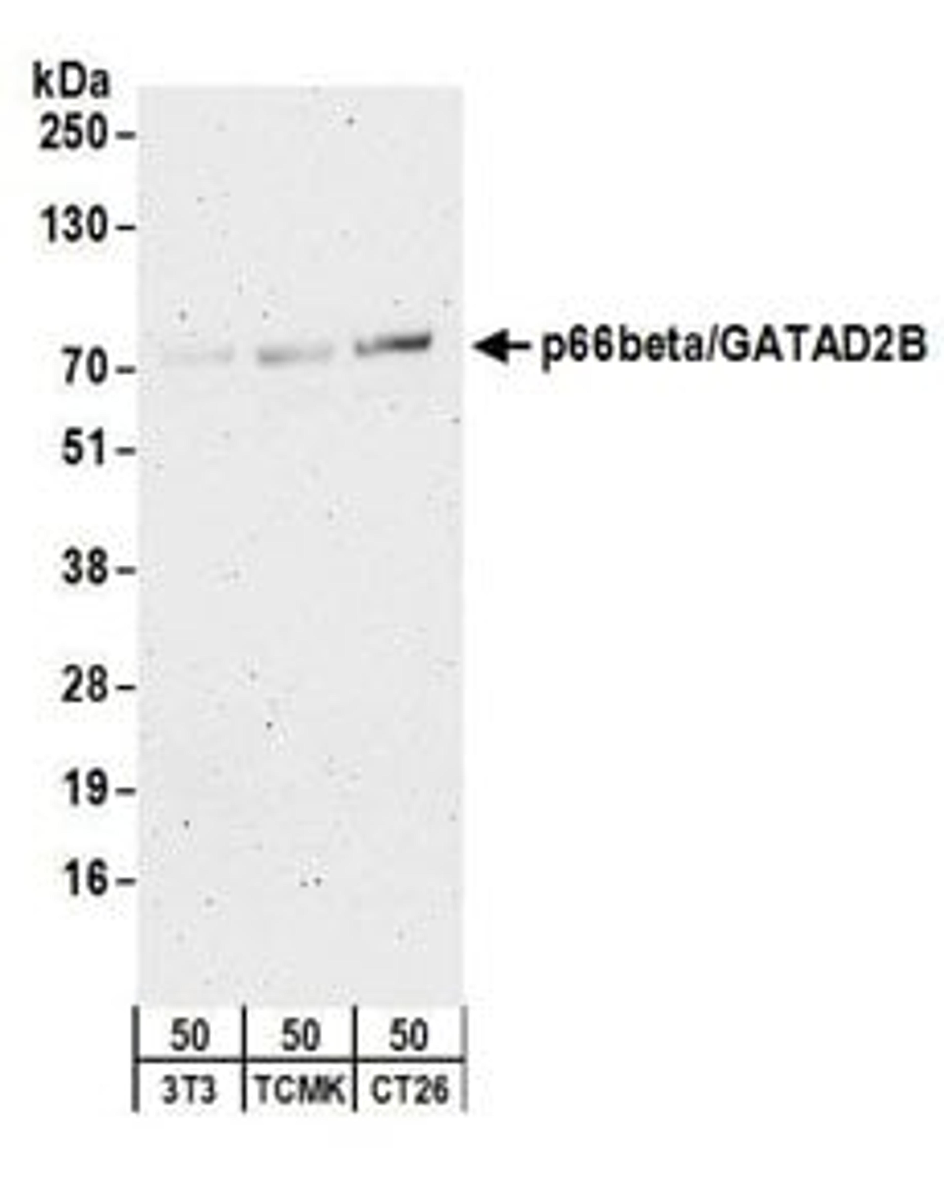 Detection of mouse p66beta/GATAD2B by western blot.