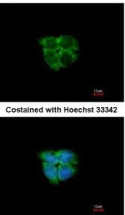 Immunocytochemistry/Immunofluorescence: ADK Antibody [NBP2-15291] - Paraformaldehyde-fixed A431, using antibody at 1:200 dilution.