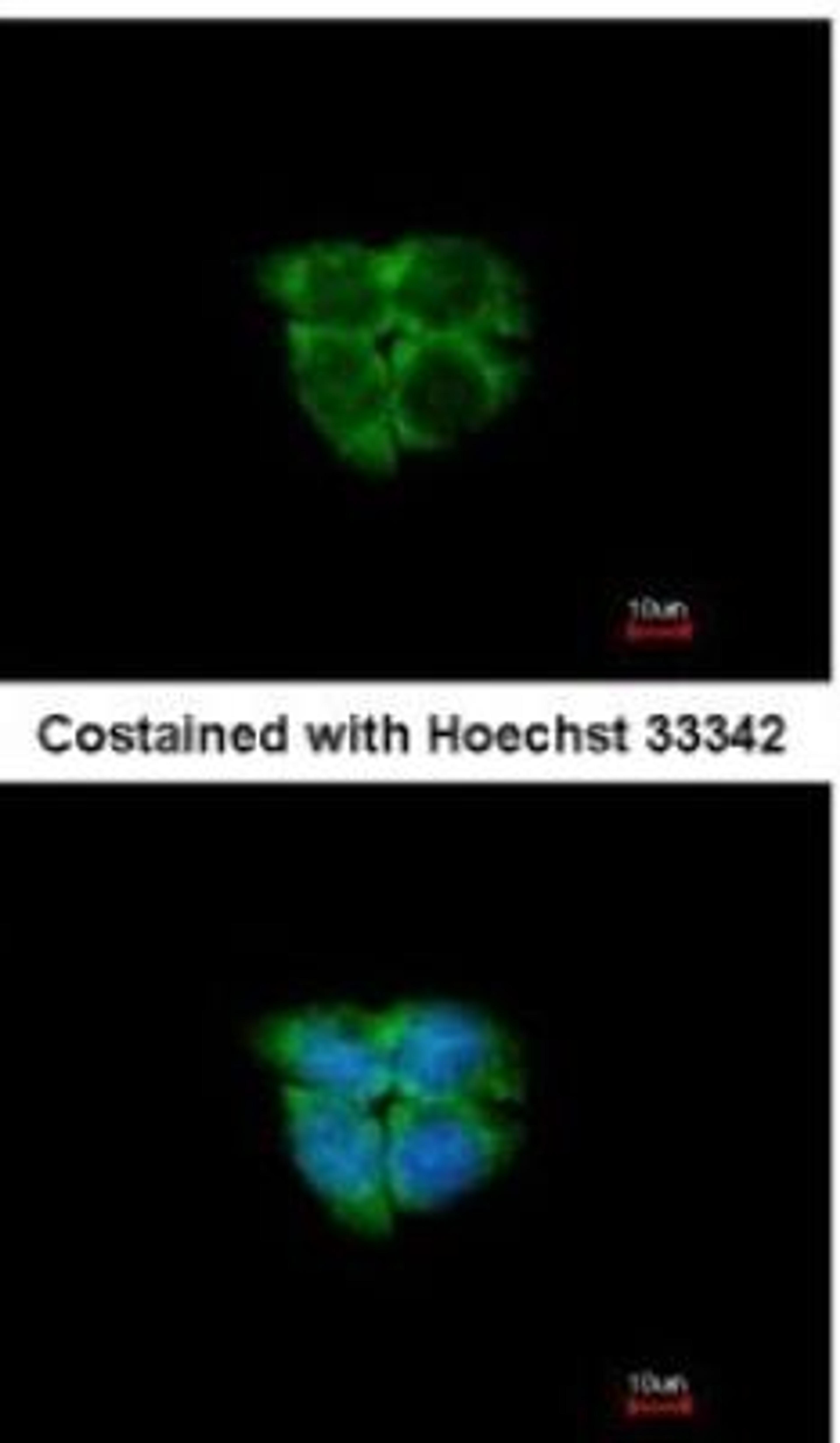 Immunocytochemistry/Immunofluorescence: ADK Antibody [NBP2-15291] - Paraformaldehyde-fixed A431, using antibody at 1:200 dilution.