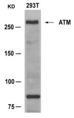 Western blot analysis of lysed extracts from 293T cells using ATM (Ab-1981).