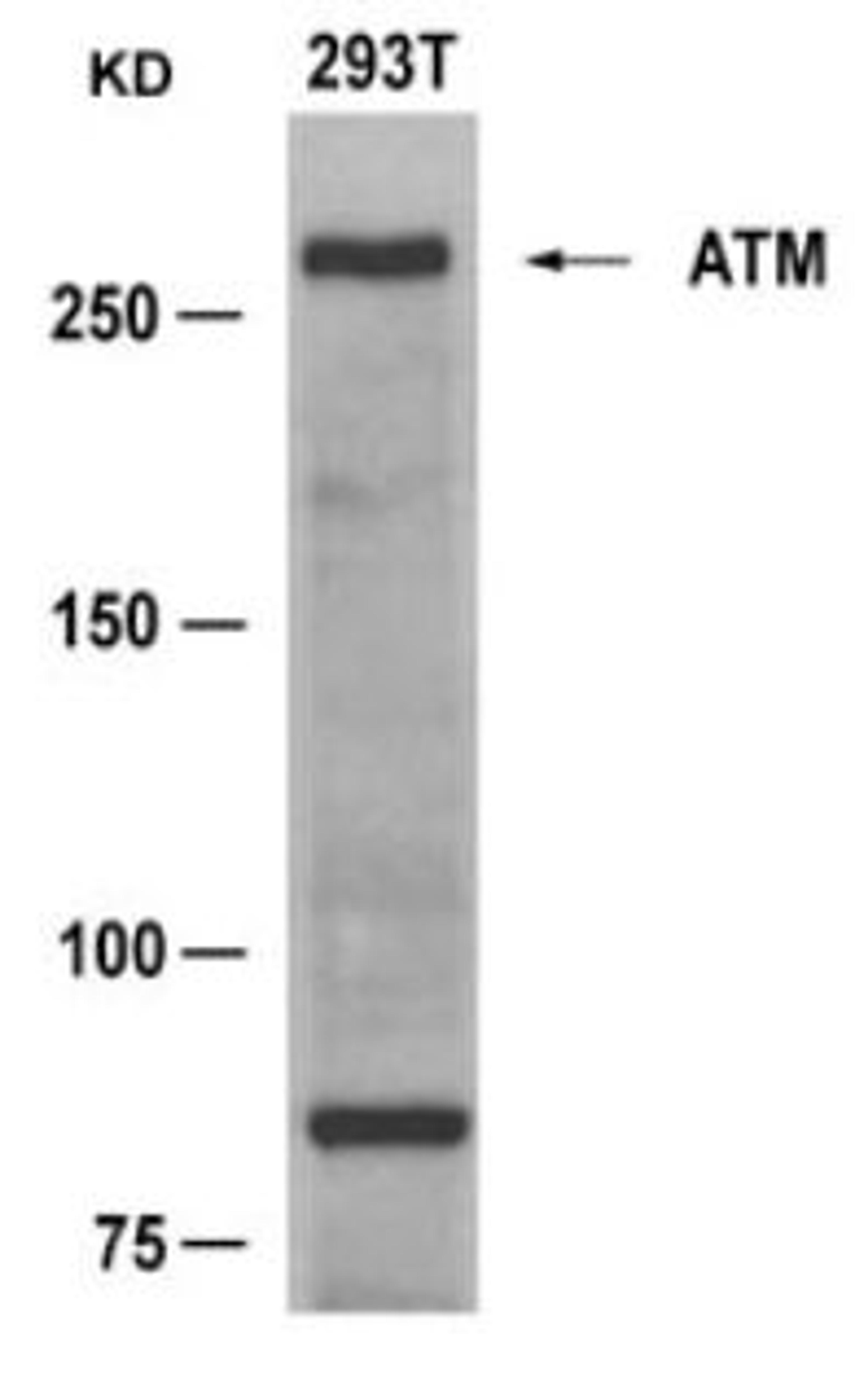 Western blot analysis of lysed extracts from 293T cells using ATM (Ab-1981).