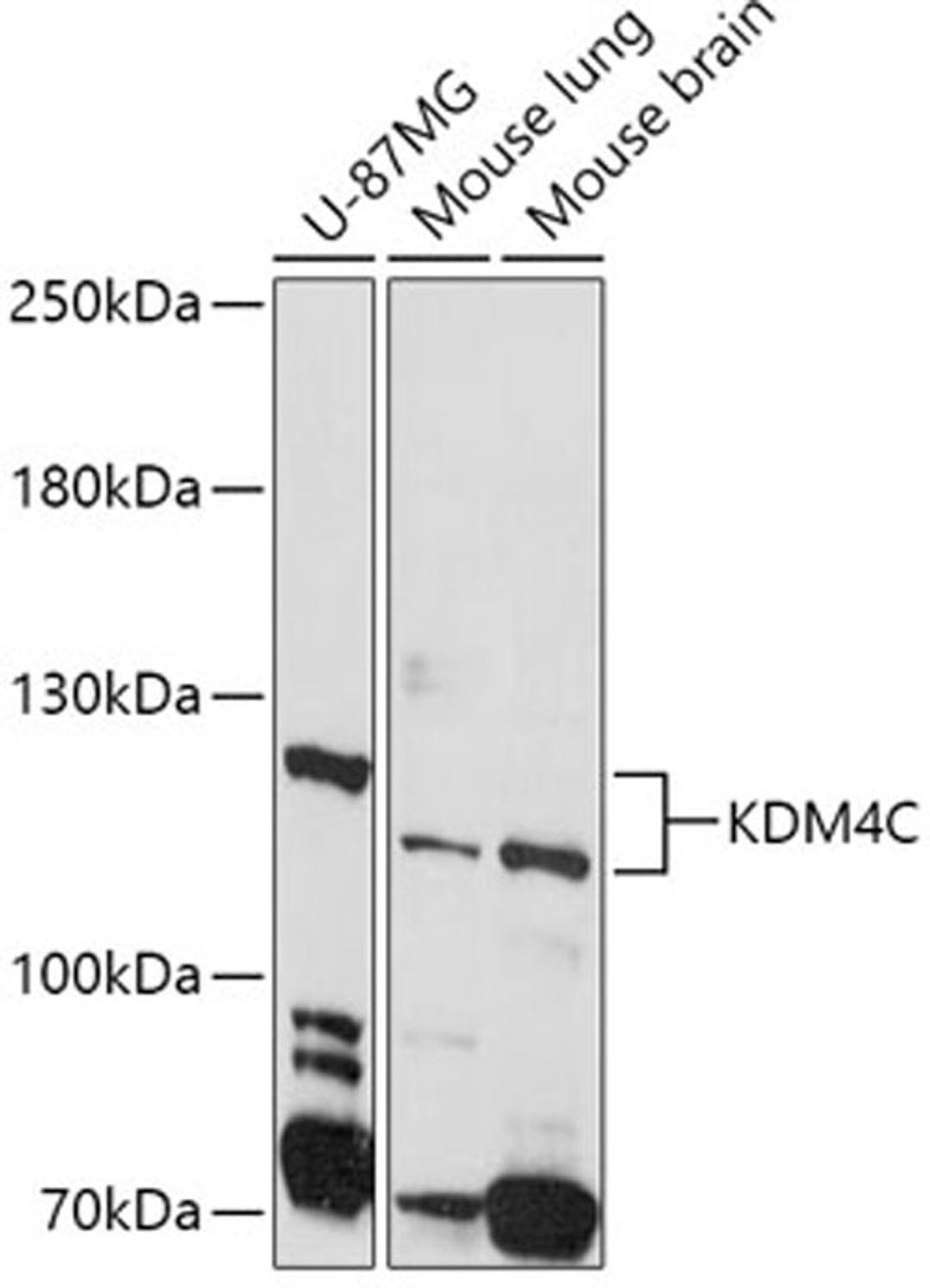 Western blot - KDM4C antibody (A8485)