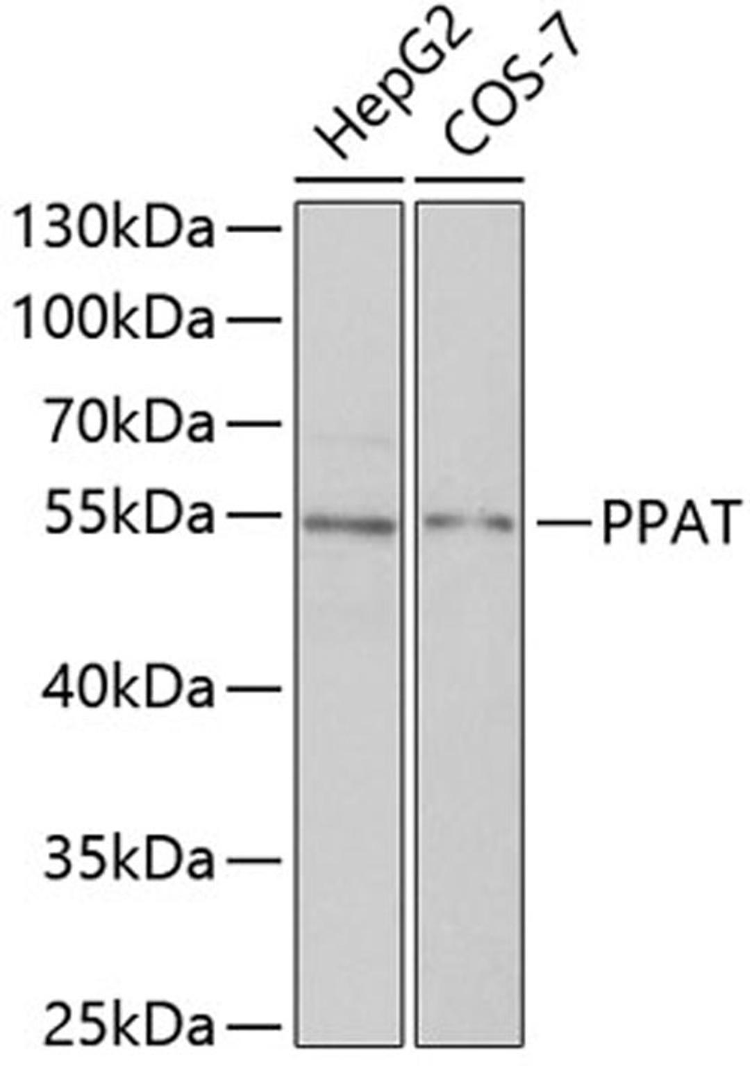 Western blot - PPAT antibody (A6698)