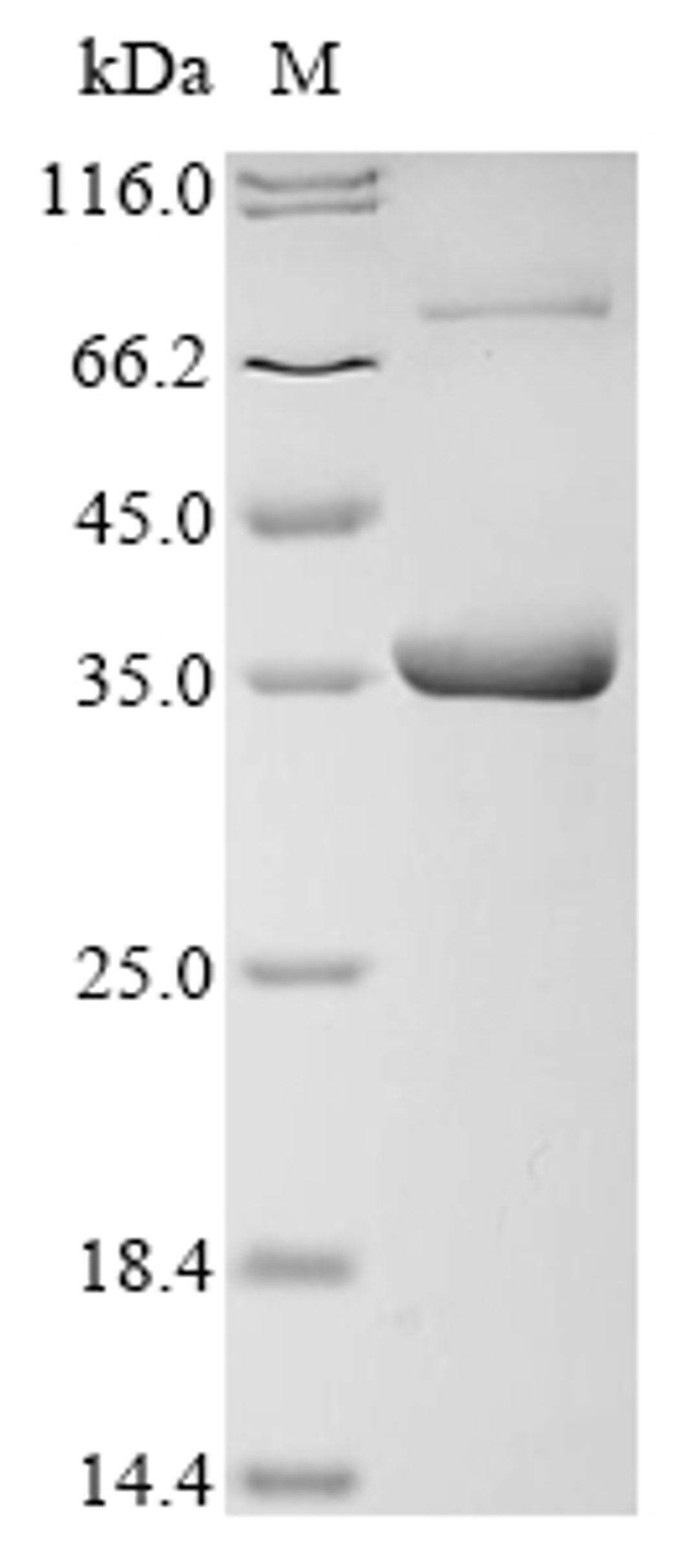 (Tris-Glycine gel) Discontinuous SDS-PAGE (reduced) with 5% enrichment gel and 15% separation gel.