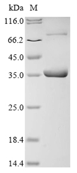 (Tris-Glycine gel) Discontinuous SDS-PAGE (reduced) with 5% enrichment gel and 15% separation gel.