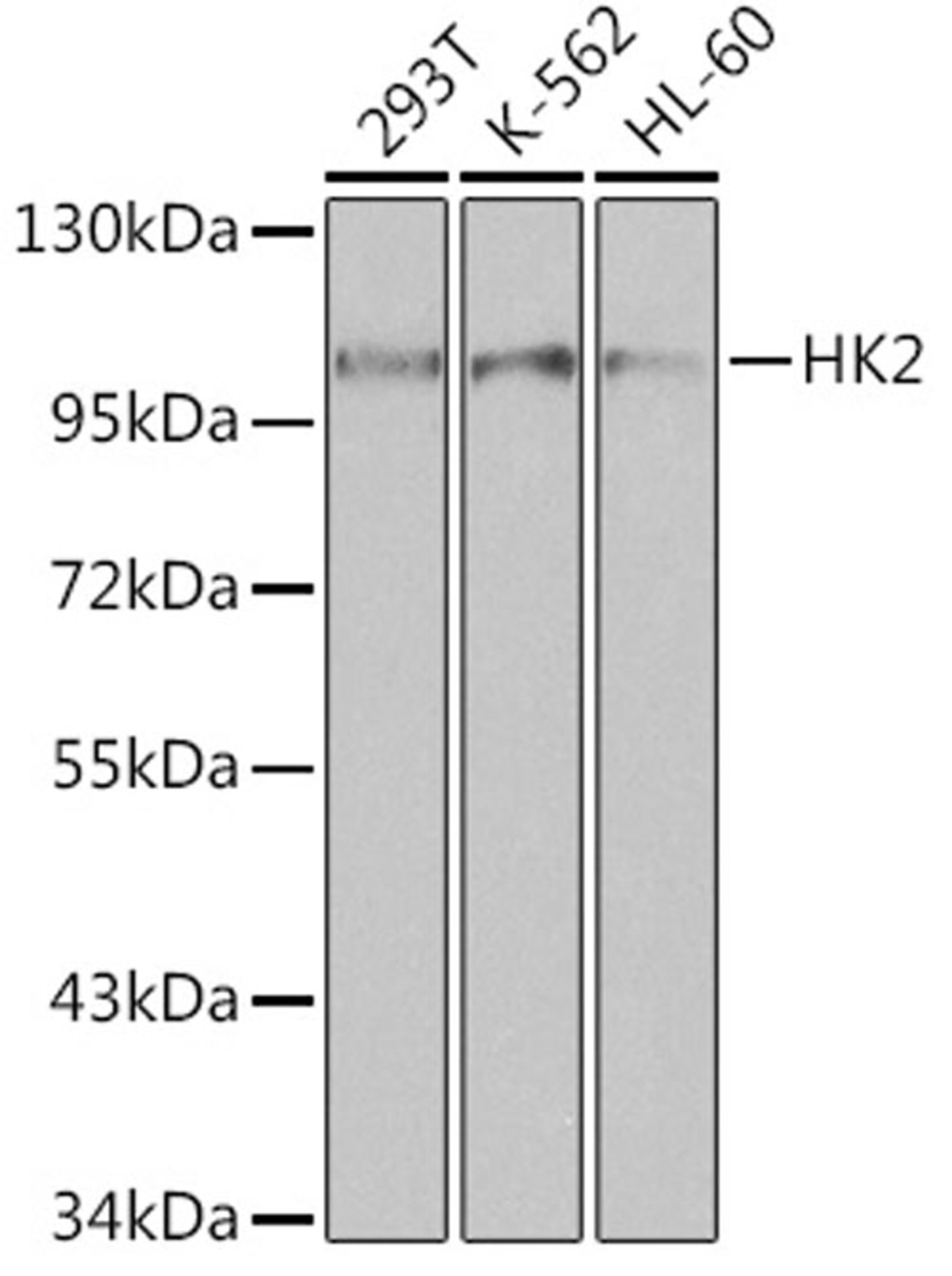 Western blot - HK2 antibody (A0994)