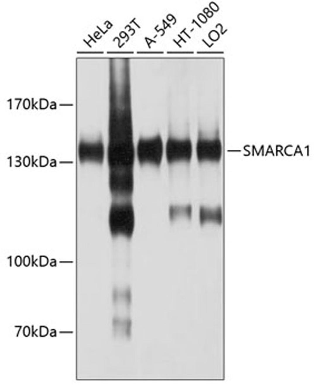 Western blot - SMARCA1 antibody (A10248)