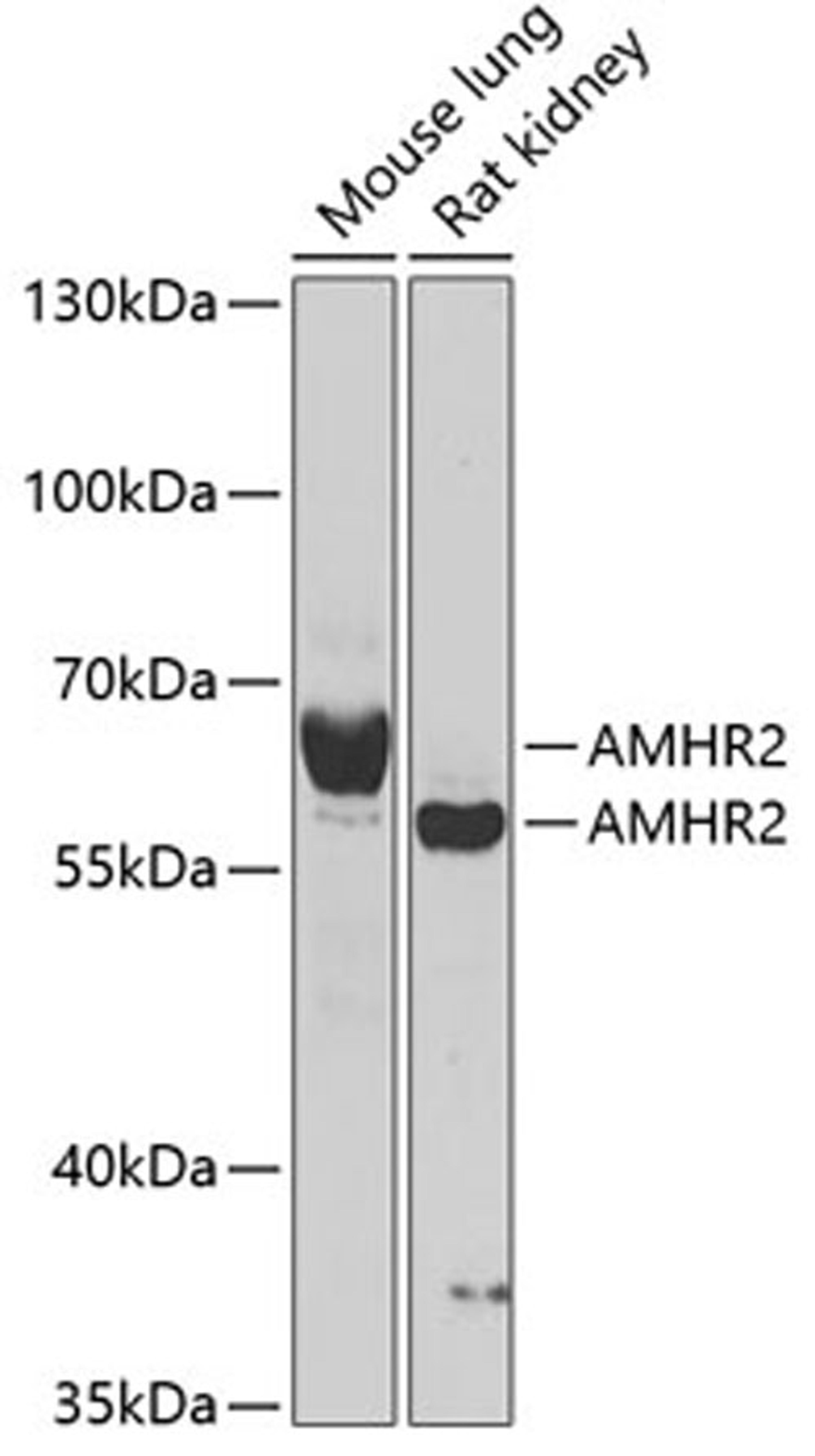 Western blot - AMHR2 antibody (A6523)