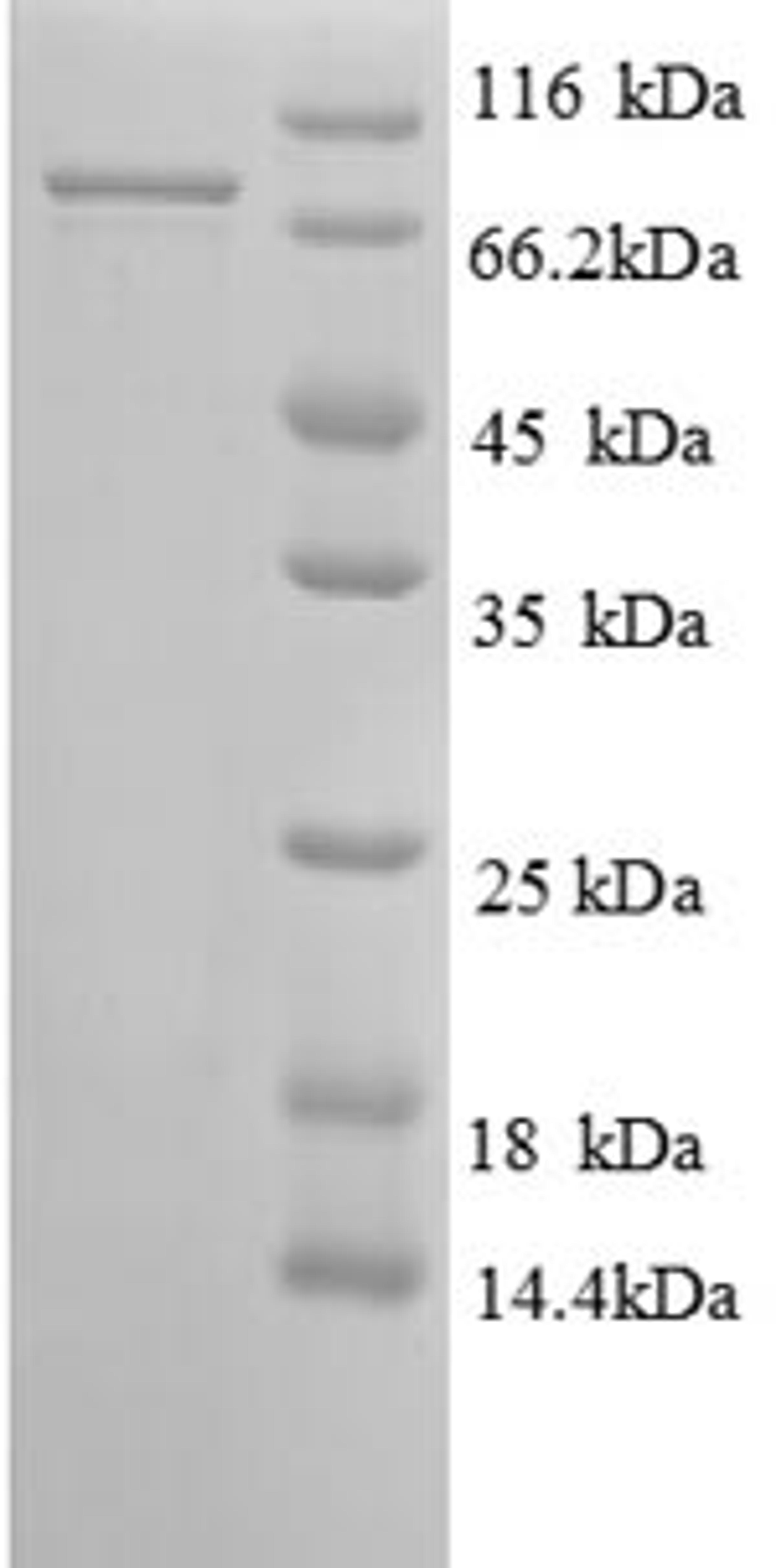 (Tris-Glycine gel) Discontinuous SDS-PAGE (reduced) with 5% enrichment gel and 15% separation gel.