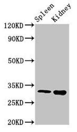 Western Blot. Positive WB detected in: Mouse spleen tissue, Mouse kidney tissue. All lanes: ABT1 antibody at 3ug/ml. Secondary. Goat polyclonal to rabbit IgG at 1/50000 dilution. Predicted band size: 32 kDa. Observed band size: 32 kDa.