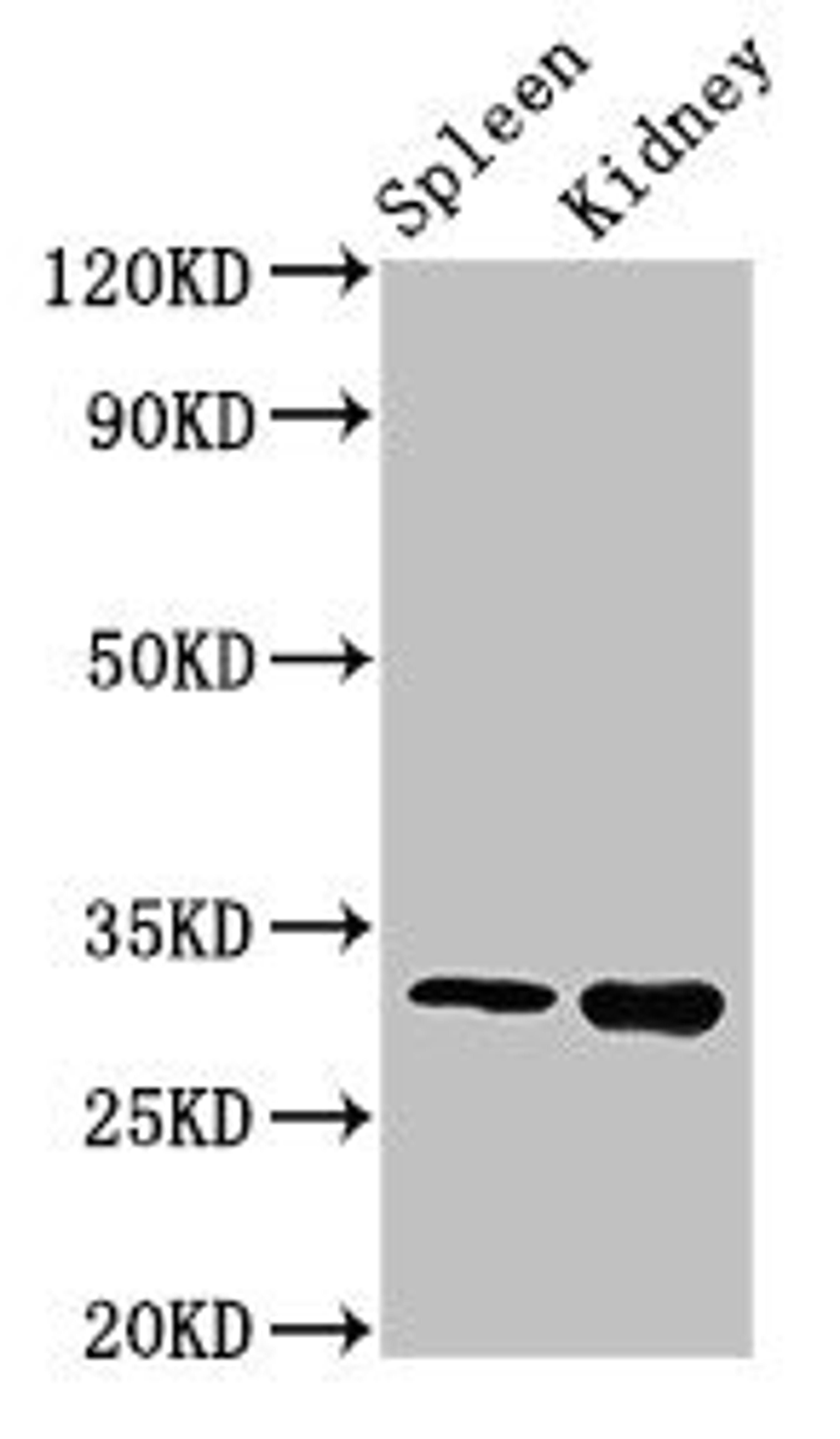 Western Blot. Positive WB detected in: Mouse spleen tissue, Mouse kidney tissue. All lanes: ABT1 antibody at 3ug/ml. Secondary. Goat polyclonal to rabbit IgG at 1/50000 dilution. Predicted band size: 32 kDa. Observed band size: 32 kDa.
