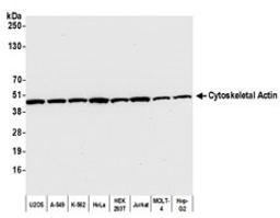 Detection of human Cytoskeletal Actin by western blot.