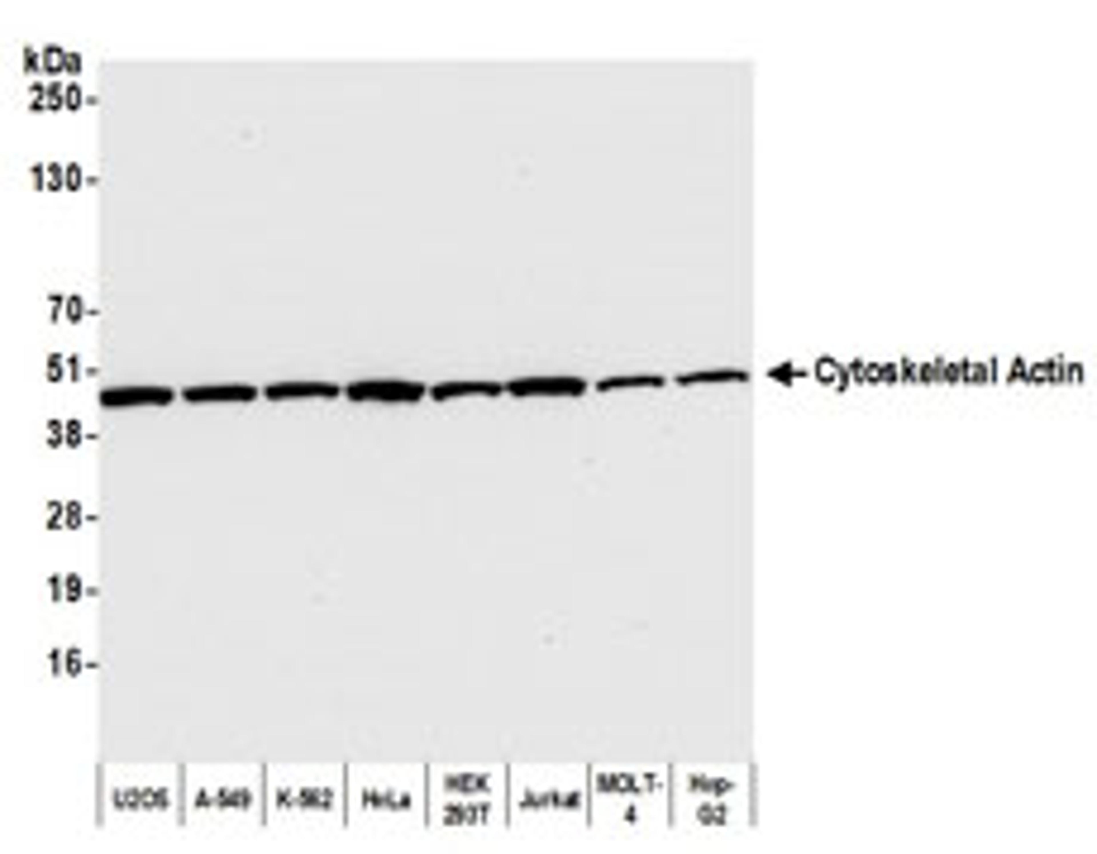 Detection of human Cytoskeletal Actin by western blot.