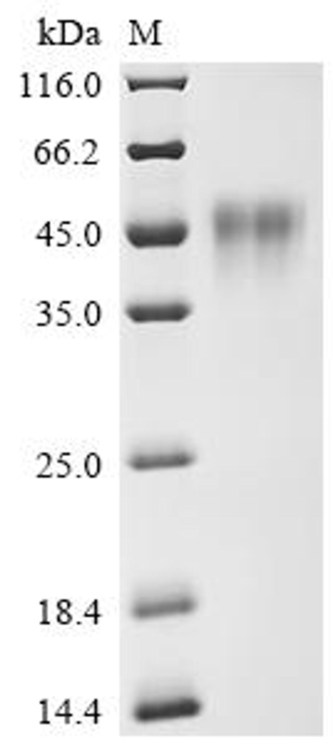 (Tris-Glycine gel) Discontinuous SDS-PAGE (reduced) with 5% enrichment gel and 15% separation gel.