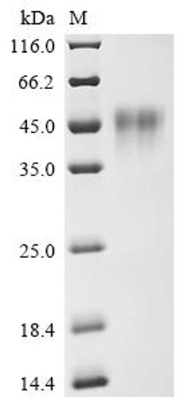 (Tris-Glycine gel) Discontinuous SDS-PAGE (reduced) with 5% enrichment gel and 15% separation gel.