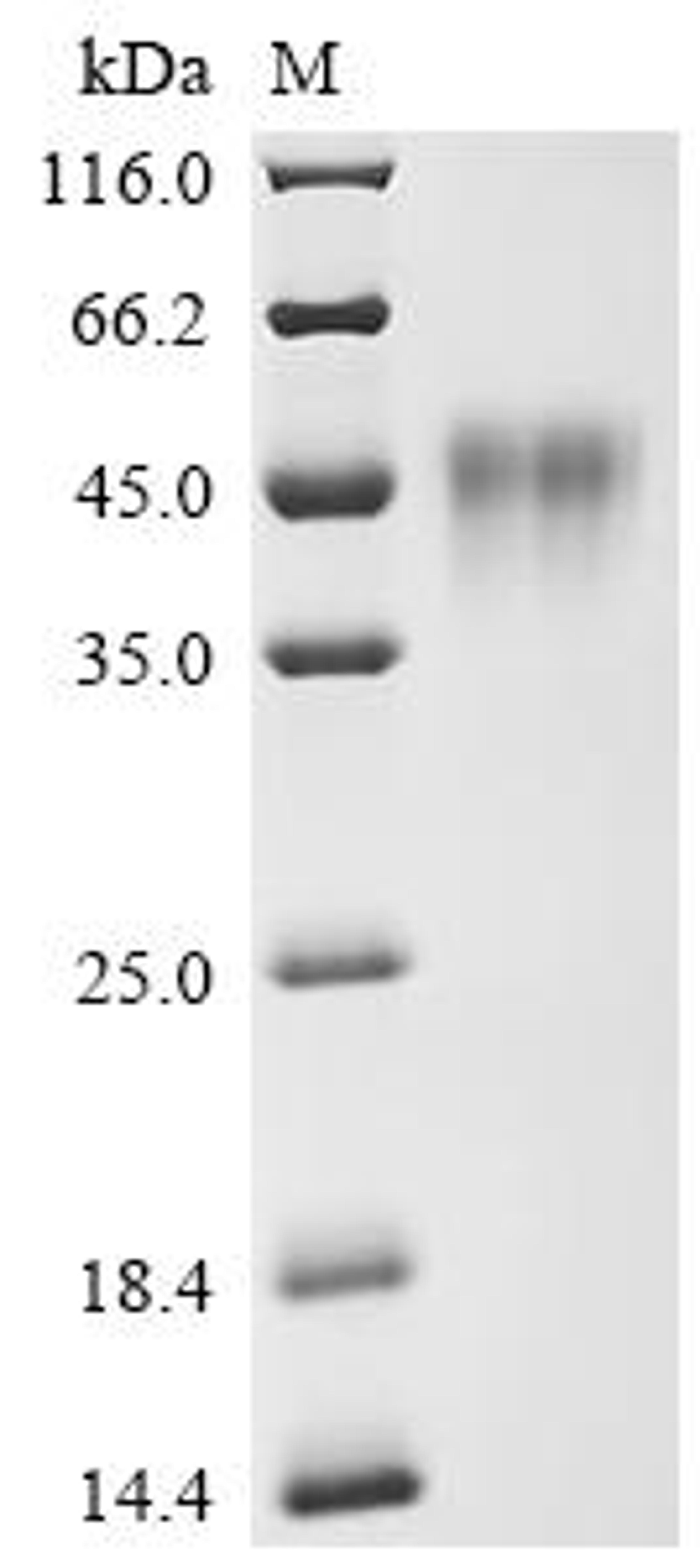 (Tris-Glycine gel) Discontinuous SDS-PAGE (reduced) with 5% enrichment gel and 15% separation gel.