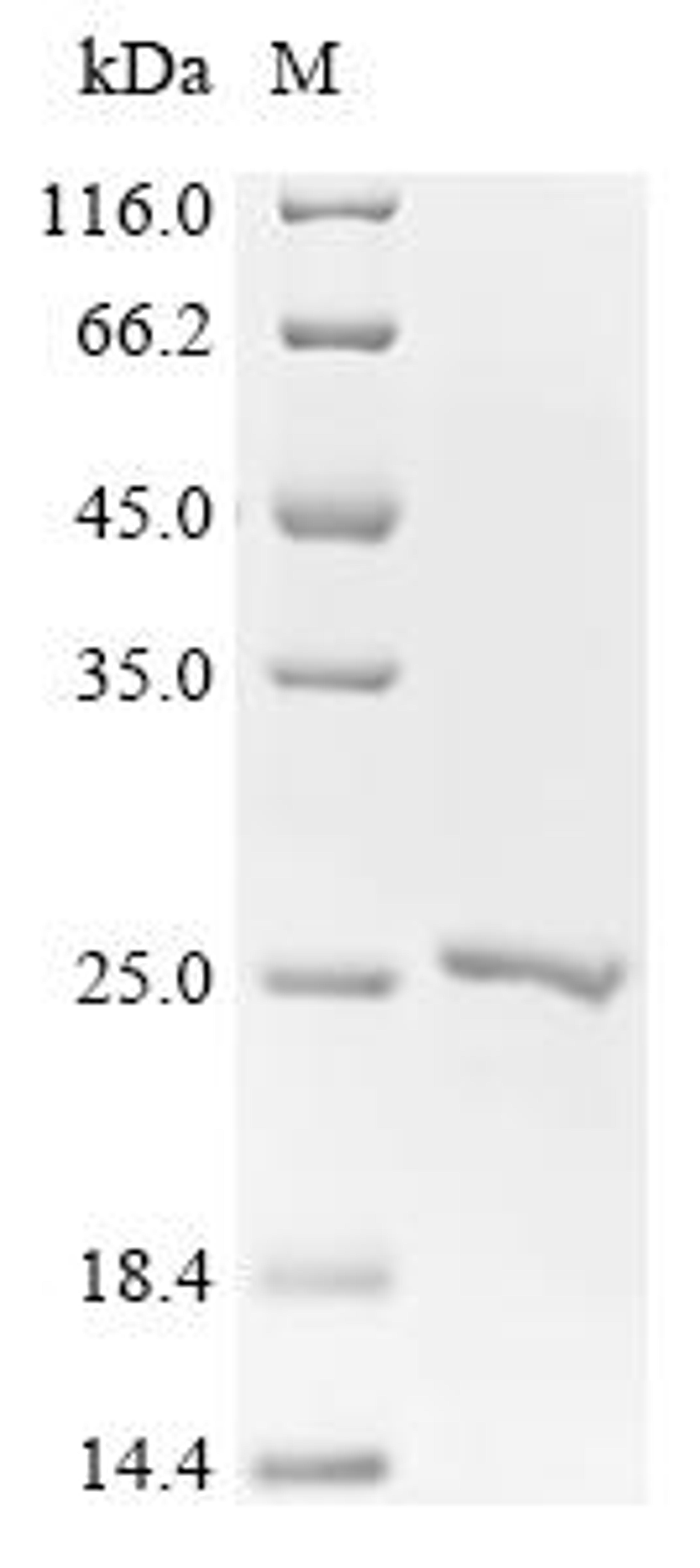 (Tris-Glycine gel) Discontinuous SDS-PAGE (reduced) with 5% enrichment gel and 15% separation gel.