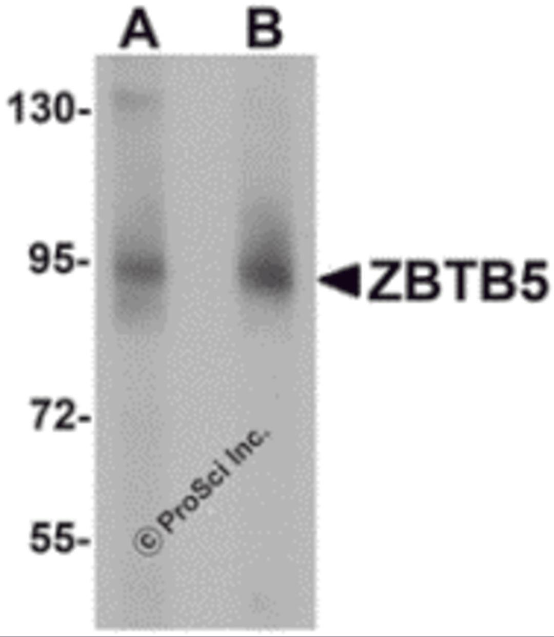 Western blot analysis of ZBTB5 in mouse brain tissue lysate with ZBTB5 antibody at (A) 1 and (B) 2 &#956;g/mL.