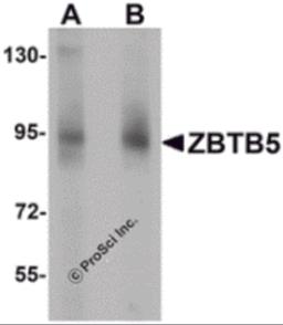 Western blot analysis of ZBTB5 in mouse brain tissue lysate with ZBTB5 antibody at (A) 1 and (B) 2 &#956;g/mL.