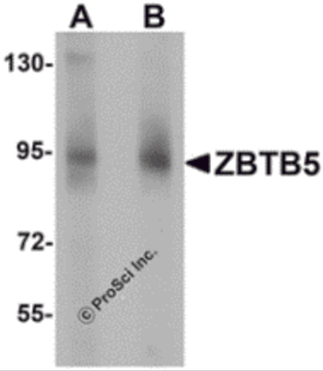 Western blot analysis of ZBTB5 in mouse brain tissue lysate with ZBTB5 antibody at (A) 1 and (B) 2 μg/mL.