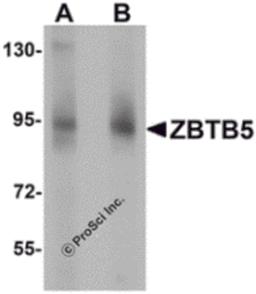Western blot analysis of ZBTB5 in mouse brain tissue lysate with ZBTB5 antibody at (A) 1 and (B) 2 μg/mL.