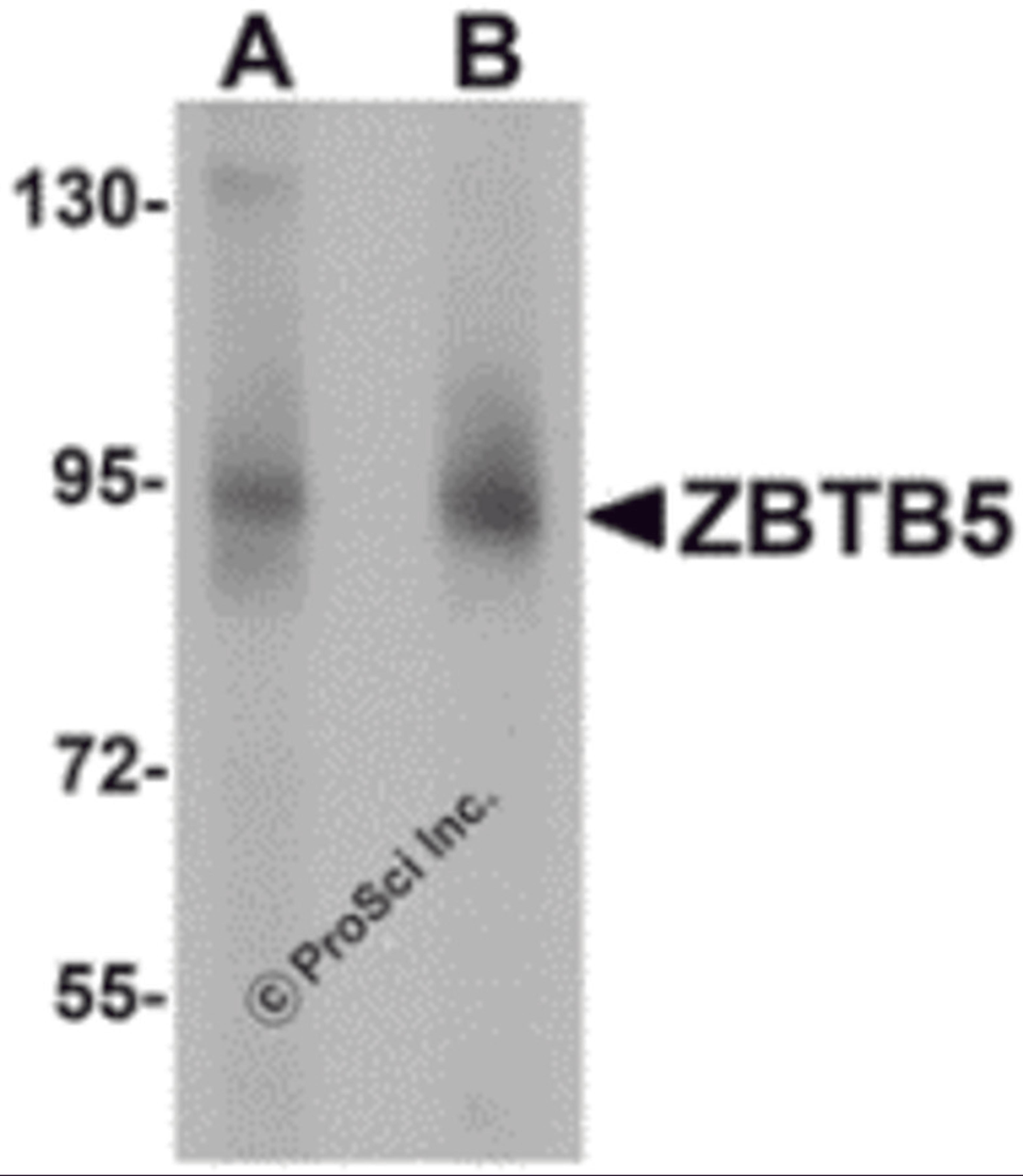 Western blot analysis of ZBTB5 in mouse brain tissue lysate with ZBTB5 antibody at (A) 1 and (B) 2 μg/mL.
